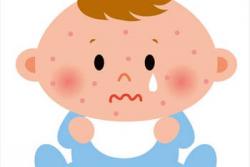乾燥の季節こそ注意！　秋冬の乳児湿疹予防法